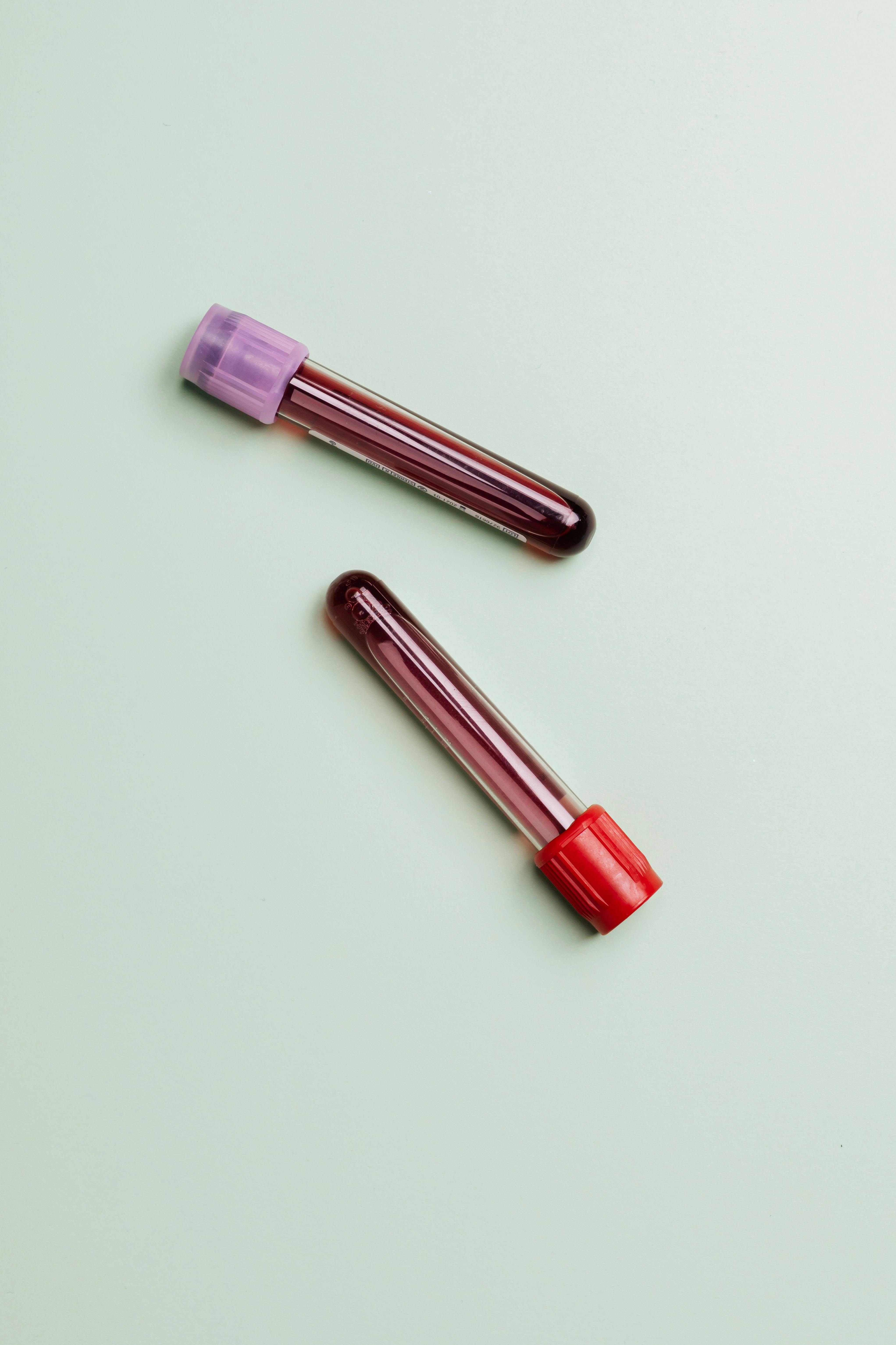 Progesterone Testing